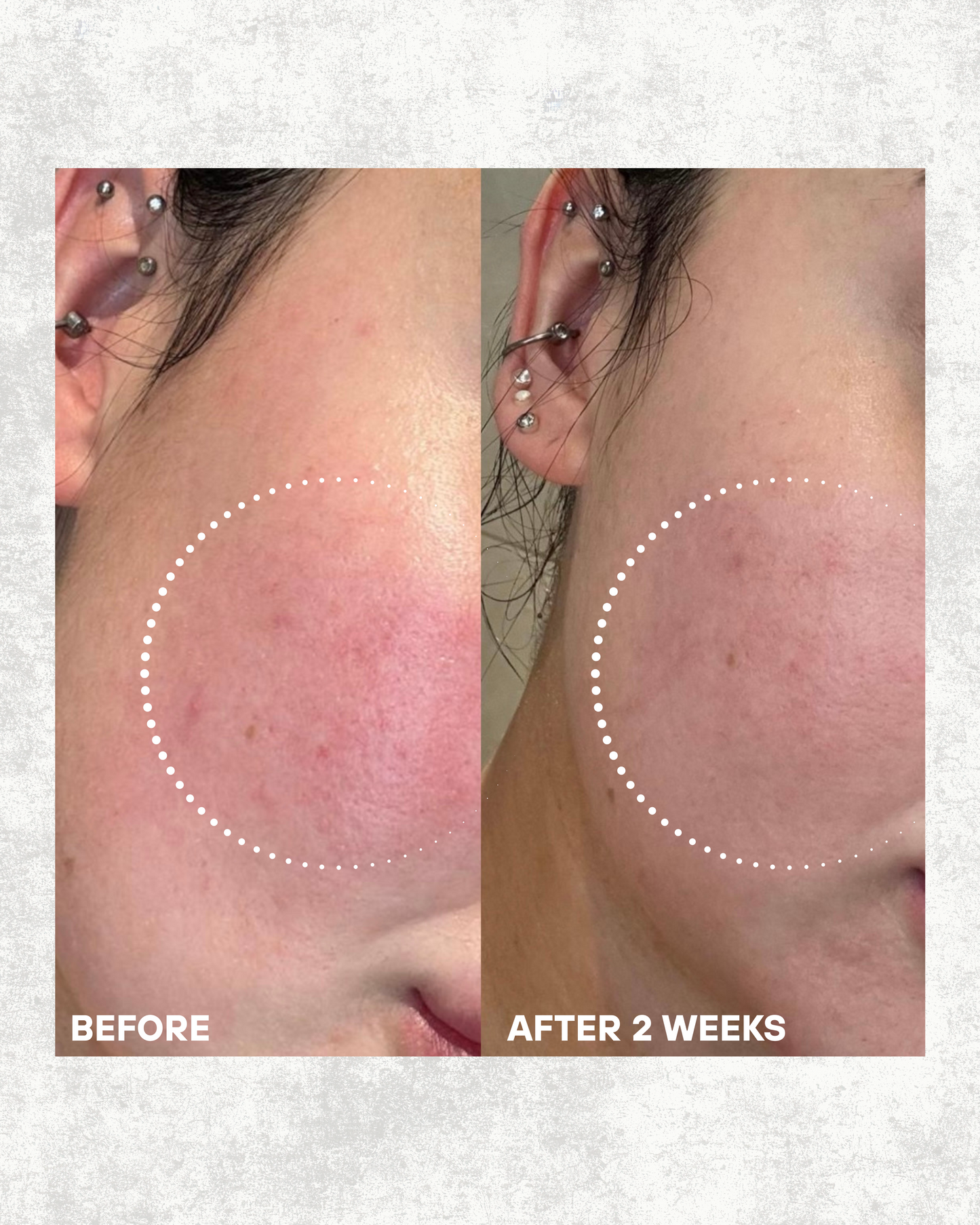 Snow Mushroom Serum